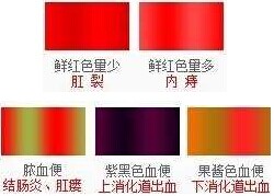 便血症状