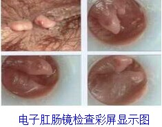 检查
