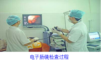 肛肠镜检查过程