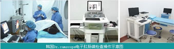 电子肛肠镜
