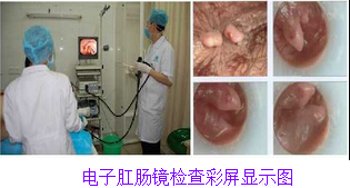 肛肠镜彩屏显示图