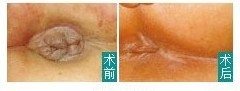 术前术后